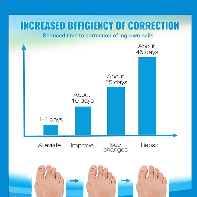 10 Pcs- Ingrown Toenail Treatment Kit with Nickel-Titanium Memory Wire, Professional At-Home Ingrown Toenail Removal kit for All Size Curve Correct, Ingrown Toenail Tools for Quick Relief.