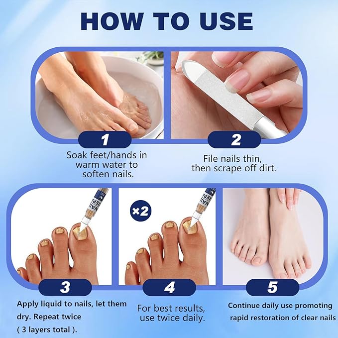 Toenail Treatment Extra Strength Pen for Toenail & Finger, More Pure Natural Plant Extracts, for Damaged Nail, Nail Repair Pen-4 pcs