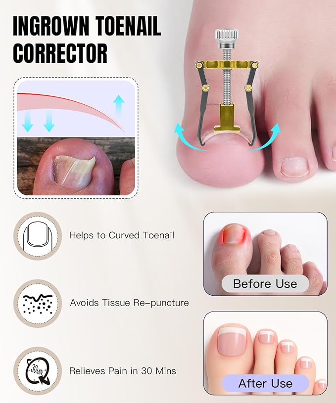 12Pcs Ingrown Toenail Removal Kit-Toenail Clippers for Ingrown & Thick & Hard Nails-Ingrown Toenail Tool with Toe Nail Clippers/Nail Cutter/Pedicure Knife/Callus Remover Tools for Seniors Men Women