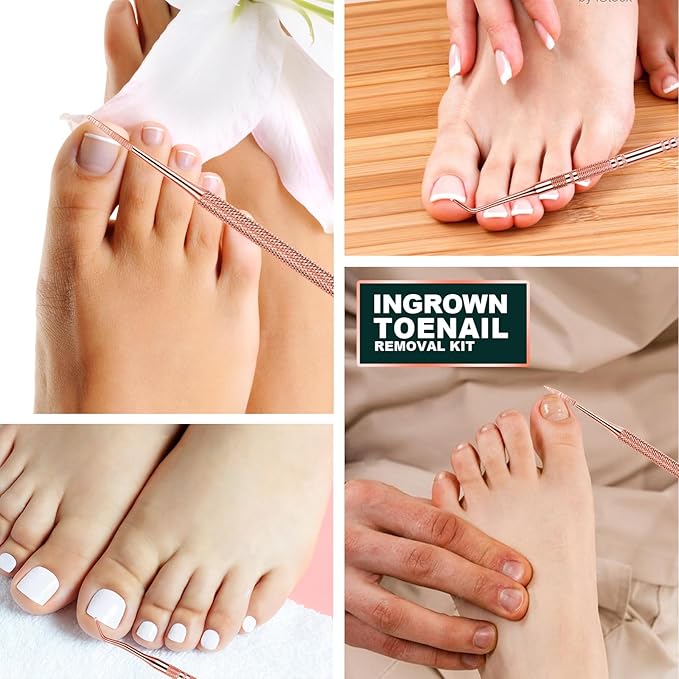 Teenitor Ingrown Toenail Tool, Toenail File and Lifters, Professional Surgical Safe Ingrown Toenail Treatment Pedicure Tools for Feet, Ingrown Toenail Removal Kit Pain Relief