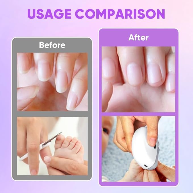 Electric Nail Clippers with Light, Baby Nail Ttrimmer Electric Automatic Finger Toe Clippers Fingernail Grinder Nail Filer Electric for Senior Adults Dual-Speed Child-Lock (White)