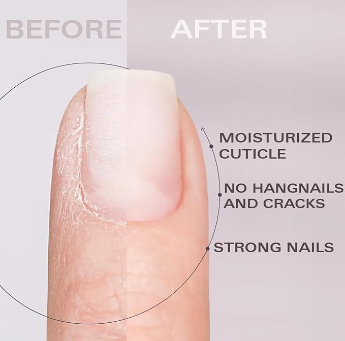 Nail Oil Cuticle Pen - Rose – Nail Strengthener & Growth Serum with Vitamin A, D, E, B5, Grapeseed & Natural Oils – Repair for Brittle, Peeling, Thin Nails – Twist Brush Pen