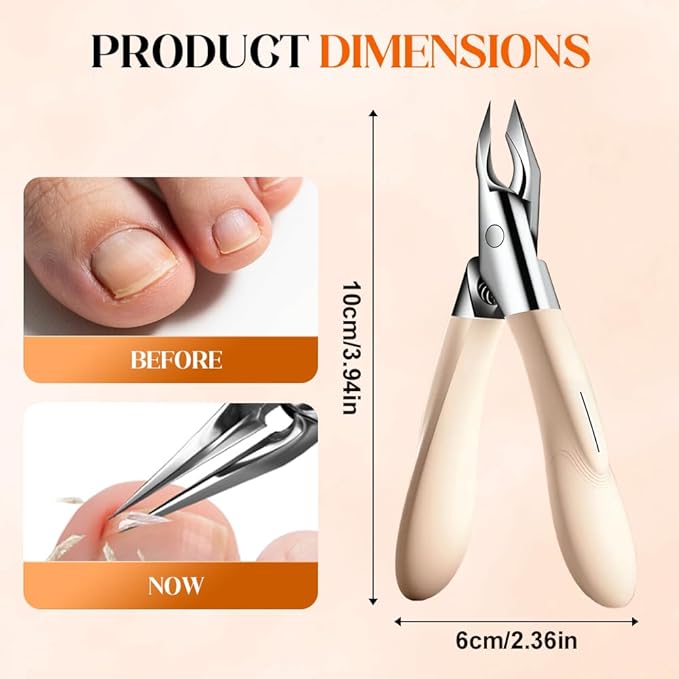 Nailpro Guard, 2025 New Designed for Ingrown and Thick Nails, Portable Ultra Sharp Stainless Steel Nail Clippers, Ultra-Thin, Easy Grip and Squeeze, Featuring Permanently Sharp Steel (Black)