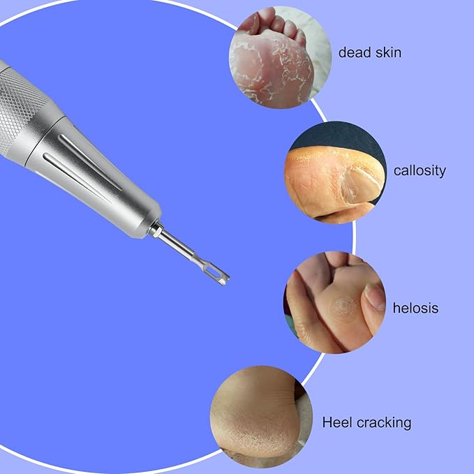 Stainless steel Corn Remover Drill Bit Medical Pedicure Faster Removal Cracked Skin Foot Callus Cuticle Cutter Toothed Bits Sanding Polishing Head,Feet Filing Nails for Manicure (2.8mm)