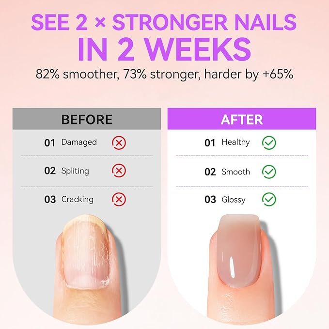Gelike EC Professional Nail Care Kit: Nude Nail Strengthener and Growth & Watermelon Cuticle Oil (15ml) - Hydrating Protein Care for Dry Nails - Lightweight Non-Sticky - Perfect for Summer Manicures