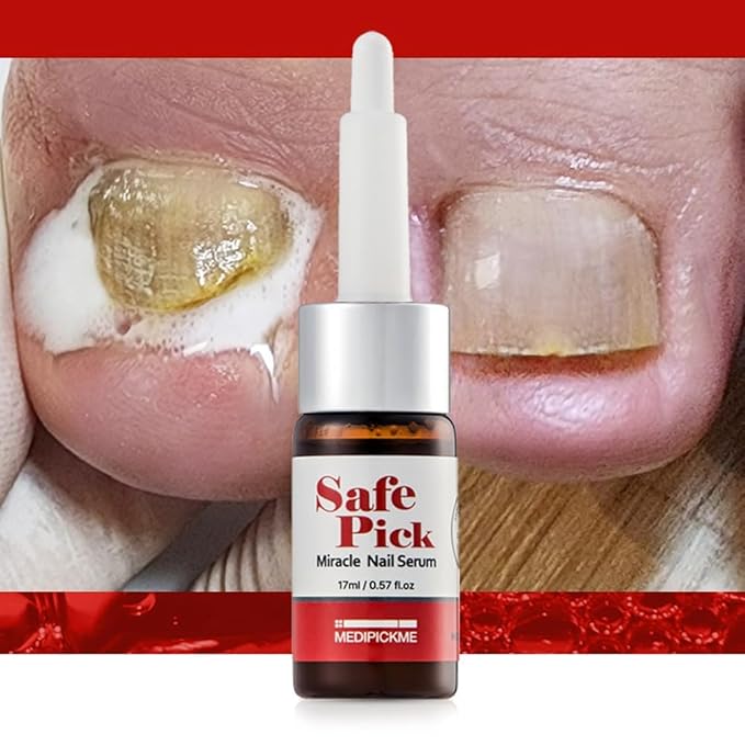 Safepick Intensive Nail Strengthener Serum for Weak, Thin & Damaged Fingernails - Keratin & Biotin Formula for Restoration & Growth Support - Quick-Drying