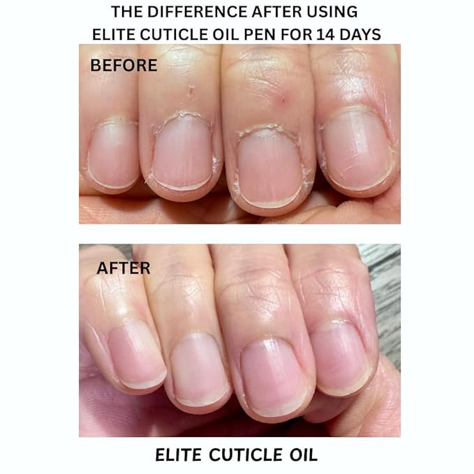Elite Cuticle Oil Pen (Rose) – Moisturizing Nail & Cuticle Treatment with Jojoba Oil, Olive Oil & Vitamin E – Nourishing Nail Care (3ML)