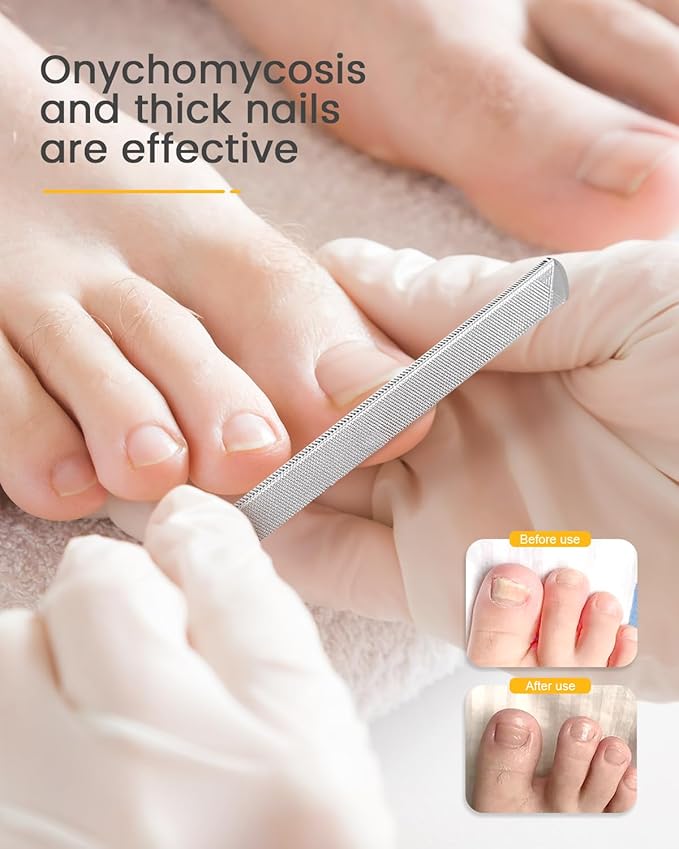 BEZOX Long Metal Nail File, Stainless Steel Fingernail File for Thick and Fungal Nails with Dual-Ended Toenail Lifter – The Ultimate Manicure & Pedicure Tool for Men and Women’s Nail Care - Silver