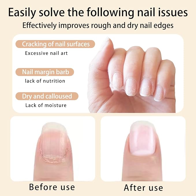 AIJIMEI Nail Oil Cuticle Pen 2pcs Nail Cuticle Oils Pens Are Nail Strengthening Agents And Nail Growth Essence, Suitable For Fragile Peeling And Broken Thin Nails（Honey & Olives）.