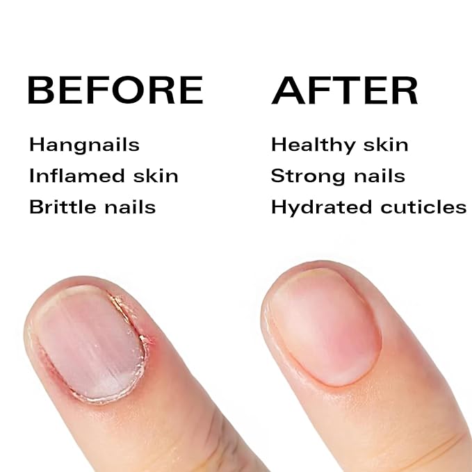 Cuticle Oil Pen - Strawberry Scent, Vitamin E Nail Strengthener and Growth Serum for Nail Care, Nourishing and Hydrating Formula for Healthier, Stronger Nails