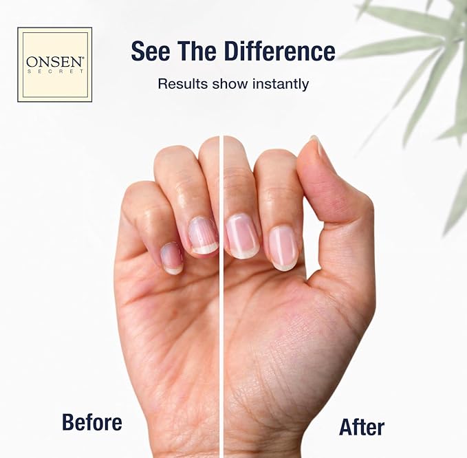 Onsen Nail & Cuticle Cream Treatment w/Japanese Tsubaki, Jojoba & Lavender Oil, Shea Butter - Strengthens Nails, Softens Cuticles - Daily Repair Care (2 Count/30 ml)