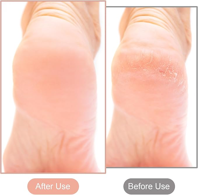 2 Pcs Glass Foot File Glass Nail File Set 8-Shaped Rough Smooth Side Callus Grinding Points Feet Files Foot Care Pedicure Tool Portable Feet Scrubber for Dead Skin Removal Cracking