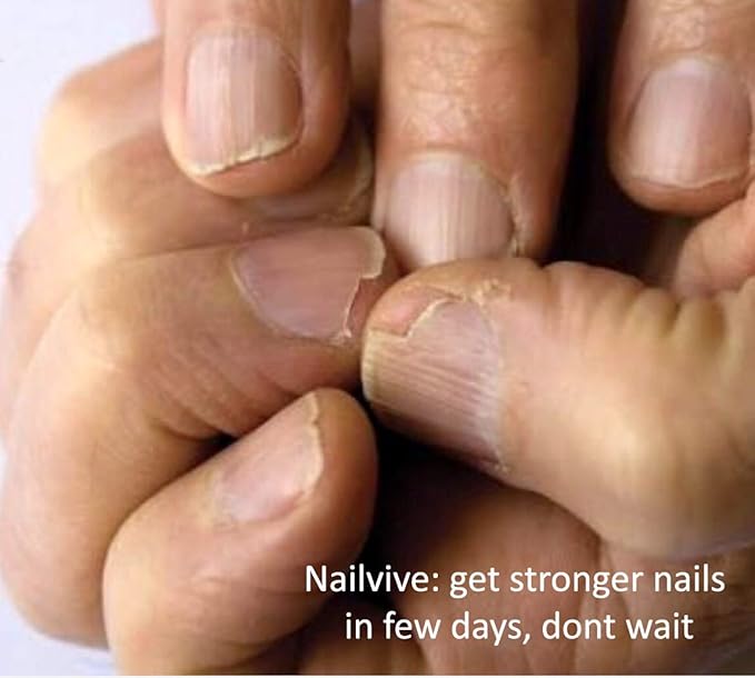 NAILVIVE Nail Serum Powerful Magic-like Silk Proteins Proven Natural Formula Strengthening Hardening nails Instantly Prevents Splits Chips Peels Cracks on Your Nails (BOTTLE APPLICATOR)