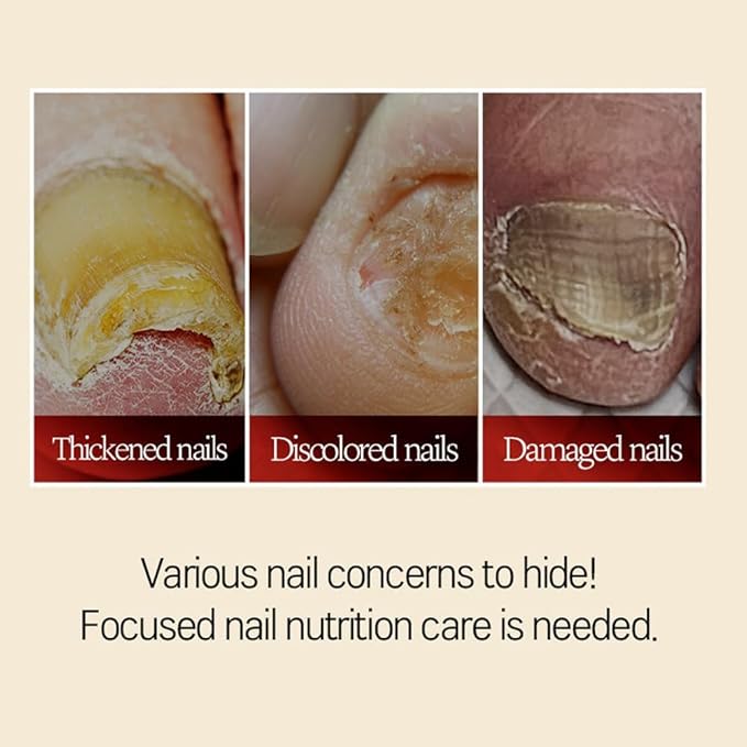 Safepick Intensive Nail Strengthener Serum for Weak, Thin & Damaged Fingernails - Keratin & Biotin Formula for Restoration & Growth Support - Quick-Drying