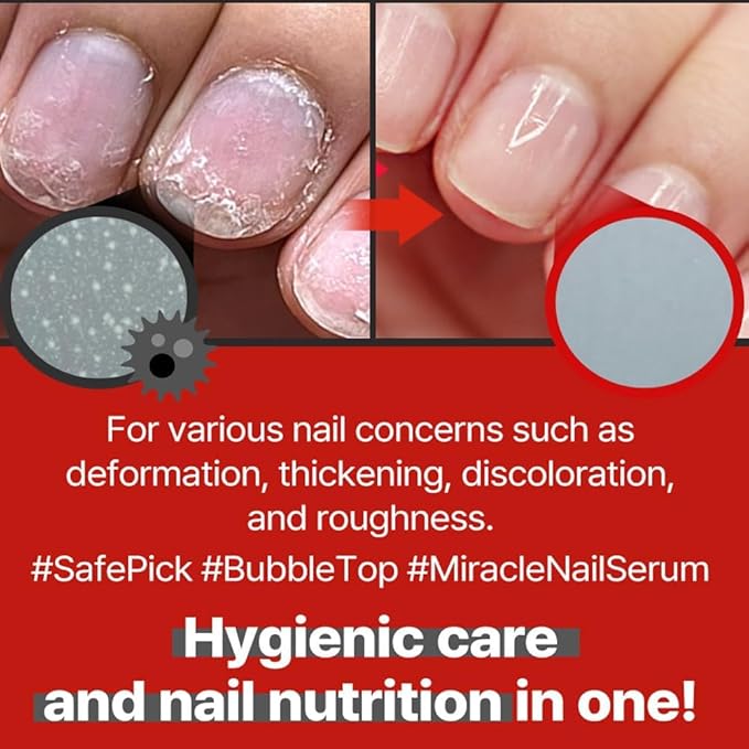 Safepick Intensive Nail Strengthener Serum for Weak, Thin & Damaged Fingernails - Keratin & Biotin Formula for Restoration & Growth Support - Quick-Drying