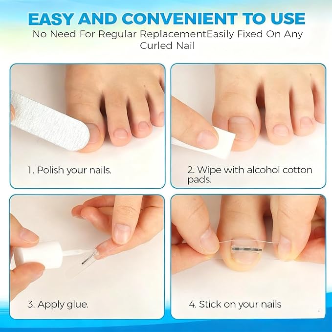 10 Pcs- Ingrown Toenail Treatment Kit with Nickel-Titanium Memory Wire, Professional At-Home Ingrown Toenail Removal kit for All Size Curve Correct, Ingrown Toenail Tools for Quick Relief.