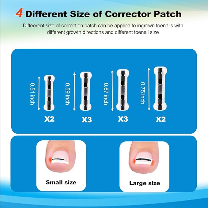 10 Pcs- Ingrown Toenail Treatment Kit with Nickel-Titanium Memory Wire, Professional At-Home Ingrown Toenail Removal kit for All Size Curve Correct, Ingrown Toenail Tools for Quick Relief.