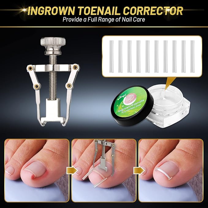 10 PCS Toenail Clippers Tool Kit, Modacraft Professional Podiatrist Nail Clippers Set for Thick & Ingrown Toenails Corrector Treatment, Wide Jaw Opening Nail Clippers Set for Seniors Pedicure, Unisex