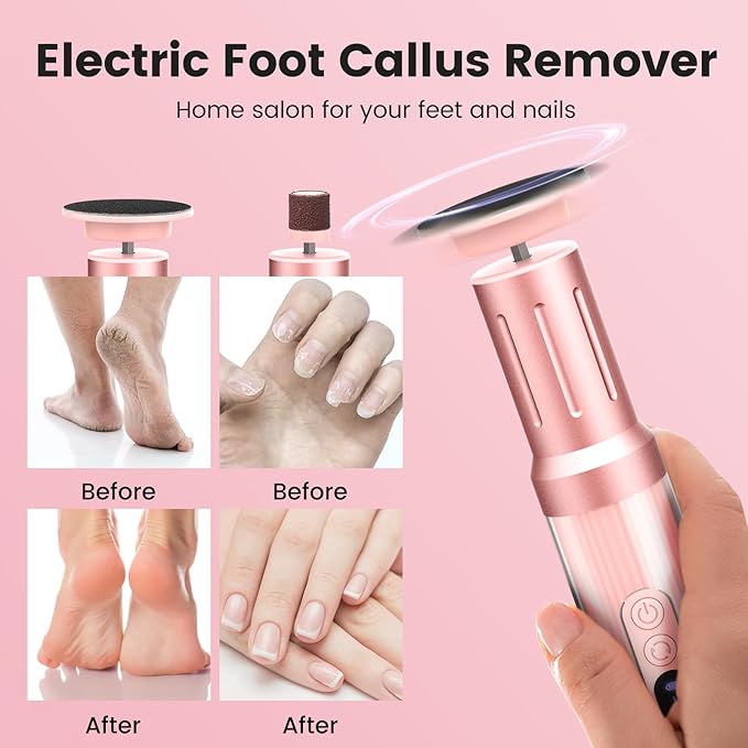 2 in 1 Electric Foot Callus Remover, 2000RPM Professional Electric Callus Remover for Feet with 6 Adjustable Settings, Rechargeable Foot File & Nail Drill with 40Pcs Sandpaper Discs (Pink)