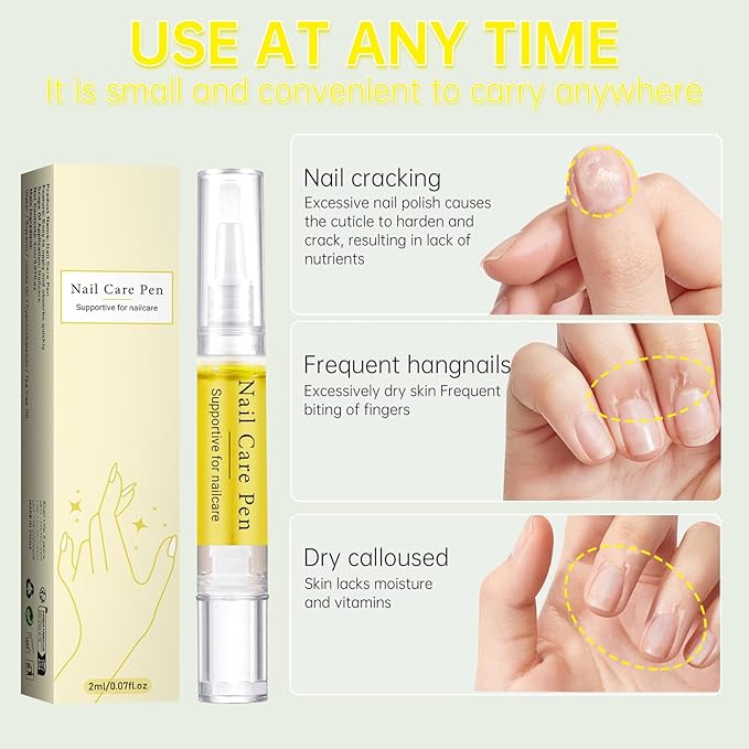 Nail Growth Oil, Rejuvenation Nail Oil Pen, Natural Rejuvenation, Instant Nail Strength, Cuticle Oil for Nails, Nail Strengthener for Moisturize Strengthen Brighten Nails Care (1)