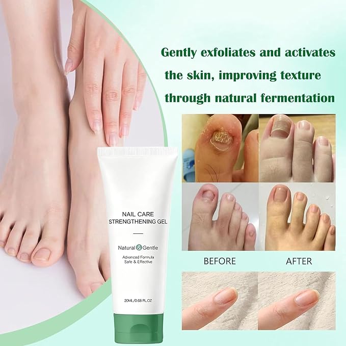 Natural Nail Care Gel, Nutraboost Strengthening Cuticle Serum for Damaged & Brittle Nails, 20ml (1 pcs) (2pcs)