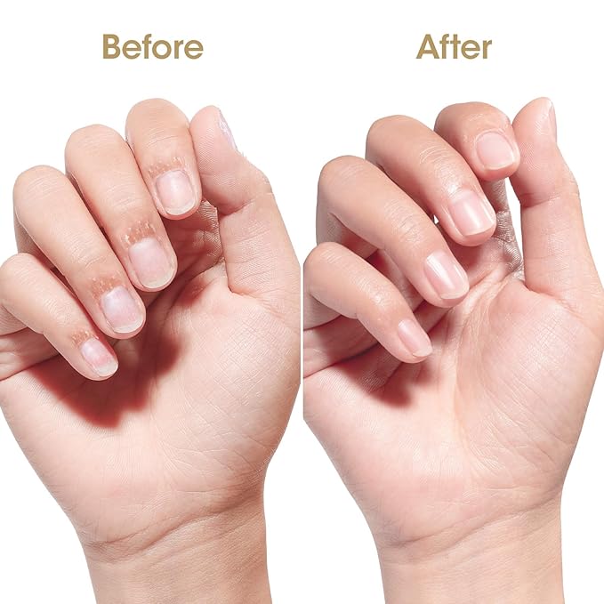 GELLEN Cuticle Oil for Growth and Strength, Vitamin E Fingernail Nourishing Oil for Hydrating, Moisturizing, Strengthening, Repairing, Nail and Skin Care Product for Men Women, Jasmine Scent
