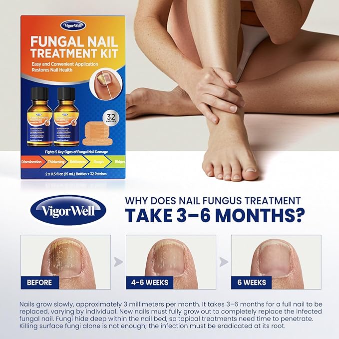 Toenail Fungus Treatment Extra Strength: Dual Action Nail Repair Kit for Thick, Brittle or Discolored Nails - 30 ml Nail Repair Gel with 25% Undecylenic Acid - (Medium) 32 Fungal Nail Patches