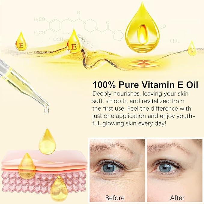 Vitamin E Oil Blend 75,000 IU, Pure Vitamin E Oil for Skin, Scars, Nails and Scalp, Face and Body Moisturizer, Hydrating Dry Skin, Reduce Stretch Marks, Fine Lines & Wrinkles, 2Fl Oz (Pack of 2)