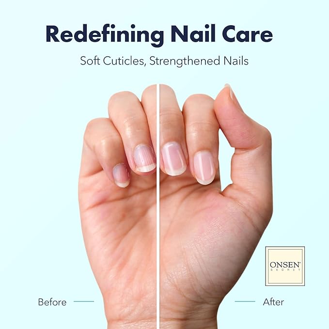 Onsen Secret Nail & Cuticle Repair Oil (10ml) - Dry Oil Formula - Japanese Tsubaki, Tea Tree & Jojoba - Strengthens Nails, Repairs Cuticles, Hydrates Skin & Hair - Natural & Vegan
