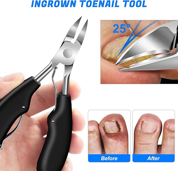 Toenail Clippers for Thick Toenails, Angled Head Toe Nail Clippers with Catcher, Heavy Duty 45° Slanted Toenail Clippers, 37mm Wide Jaw Nail Clippers with Long Handle, 6PCS