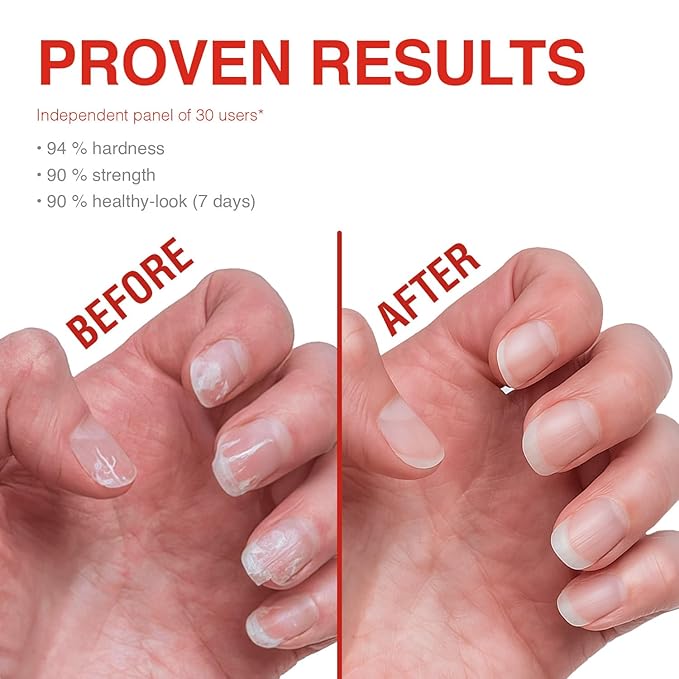 Probelle Nail Strengthener, Nail Strengthening Treatment, Nail Growth and Repair, Stops Peeling, Splits, Chips, Cracks, and Strengthens Nails (0.50 ounces, 3)