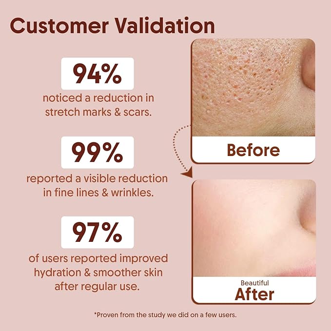 Vitamin E Oil For Face - 30 ml | Best Oil For Face, Body and Nail From Veg Vitamin E Source | Nourish Your Face and Repair Damaged Skin Naturally.