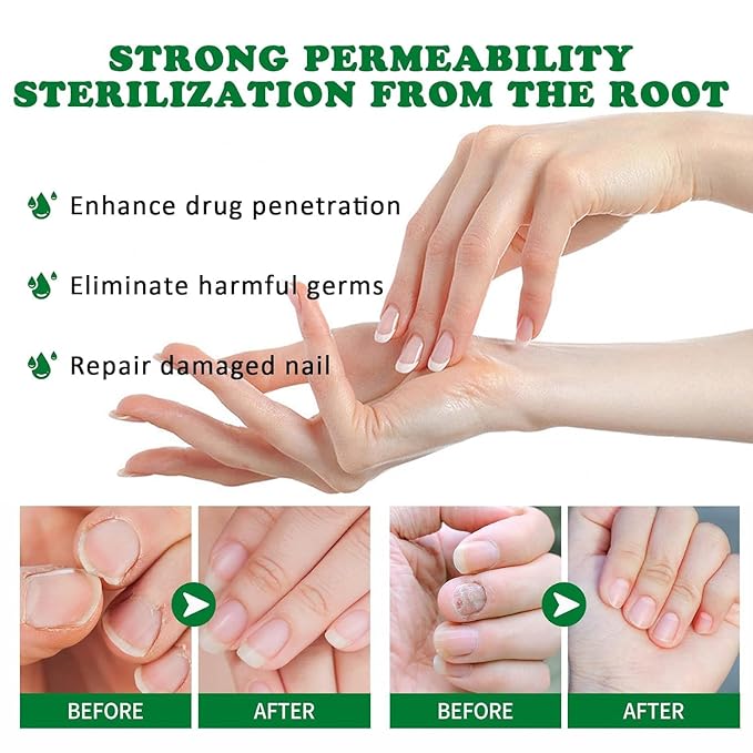 Natural Nail Treatment Gel, Nail Growth Serum for Repair & Strengthener (2)