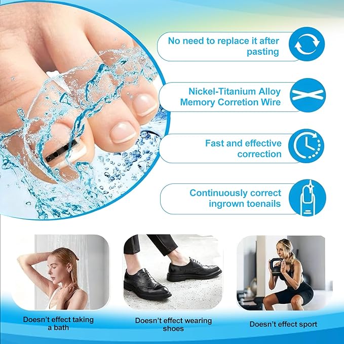 10 Pcs- Ingrown Toenail Treatment Kit with Nickel-Titanium Memory Wire, Professional At-Home Ingrown Toenail Removal kit for All Size Curve Correct, Ingrown Toenail Tools for Quick Relief.