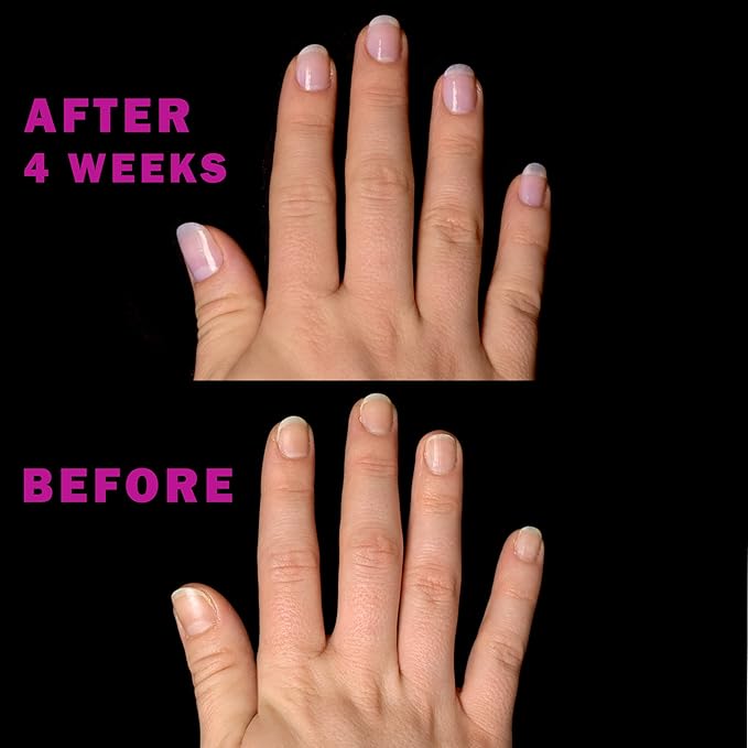 Perfect Formula Pink Gel Coat - Nail Strengthener and Strengthening Polish for Women, Extra Strong Nail Hardener, Keratin Treatment for Damaged Fingernails