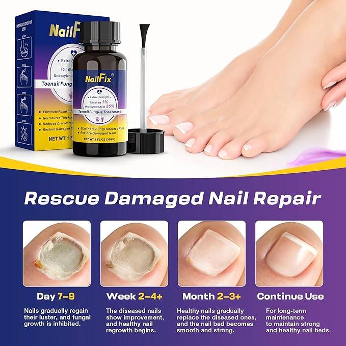 Toenail Fungus Treatment Extra Strength - Upgraded Toe Nail Fungus Treatments, Antifungal Nail Treatment with 25% Undecylenic Acid & Tea Tree Oil - Damaged Nails Foot Fungus Treatment Extra Strength
