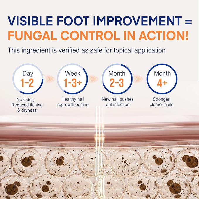 Toenail Fungus Treatment Extra Strength: Dual Action Nail Repair Kit for Thick, Brittle or Discolored Nails - 30 ml Nail Repair Gel with 25% Undecylenic Acid - (Medium) 32 Fungal Nail Patches