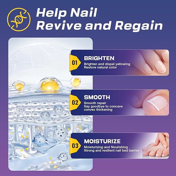 Toenail Fungus Treatment Extra Strength - Upgraded Toe Nail Fungus Treatments, Antifungal Nail Treatment with 25% Undecylenic Acid & Tea Tree Oil - Damaged Nails Foot Fungus Treatment Extra Strength