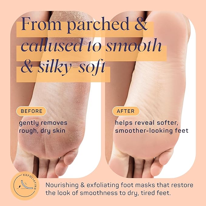 SpaLife Beauty Sole Mates Exfoliating Foot Masks –For Callus Removal with Macadamia Oil, Walnut Shell, and Eucalyptus Oil – 8 Pack